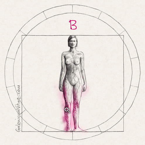 Varices y sus causas