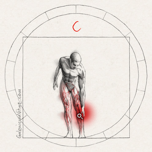 Arteriopatía periférica y sus causas