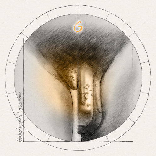 Virus del papiloma humano (VPH) y sus causas