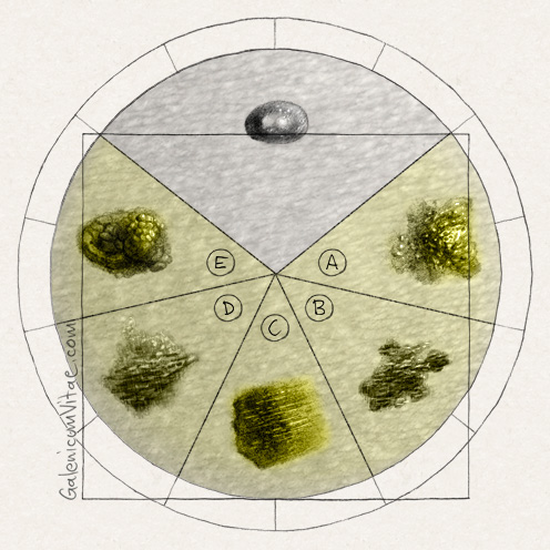 Melanoma y sus causas